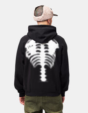 Dime MTL Spinal Zip Hoodie - Black